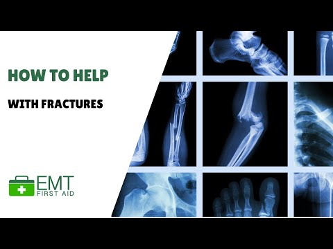 How to help with a fracture |  Adult First Aid  | EMT First Aid Training |