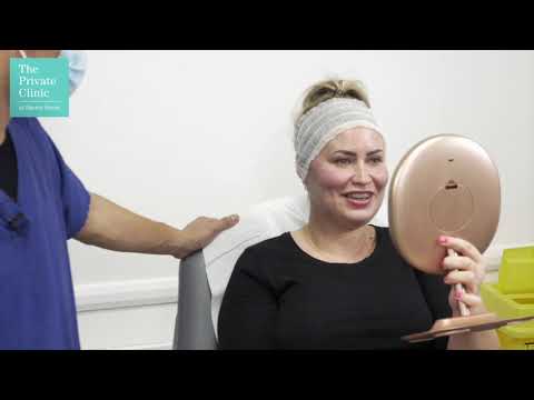 Cheek and Jawline Contour with Dermal Fillers at The Private Clinic