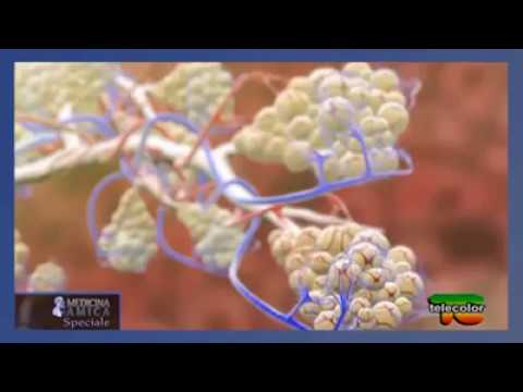 Quali farmaci per la persona per vermi Come posano uova di helminths