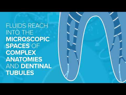 Sonendo GentleWave Procedure Overview