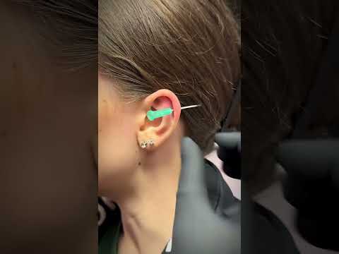 This Is For You If You Want a Helix Piercing ✨ @undergroundbodypiercing  #earpiercing #piercing