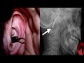 What Happens If An Earwig Gets Into Your Ear? / Documentary (English/HD)