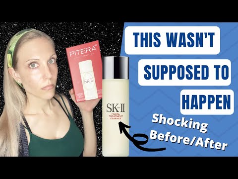 SK-II Pitera Essence vs. Cosrx Galactomyces…