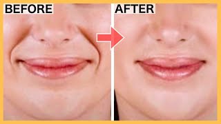 SMILE LINES Facial Exercises (Nasolabial Folds/ Laugh Lines) | Lift Smile Lines with this WORKOUT!