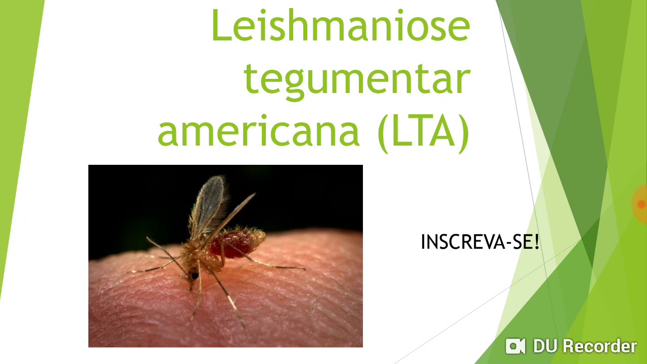 Leishmaniose tegumentar americana