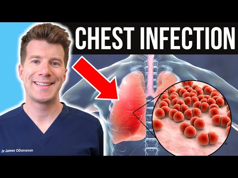 Do I have a Chest Infection? Doctor explains symptoms and treatment (including antibiotics)