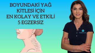 BOYUNDAKİ YAĞ KİTLESİNDEN NASİL KURTULURSUNUZ? / HOW TO GET RID OF NECK HUMP wit
