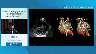 제10회 선천성심장병센터 심포지엄 : What echocardiographic results does the surgeon want before surgery? 미리보기
