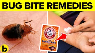 13 Natural Bug Bite Remedies That Work