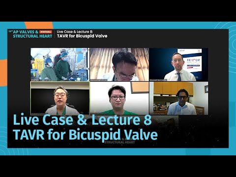 [AP VALVES & SH 2021] Live Case & Lecture 8: TAVR for Bicuspid Valve