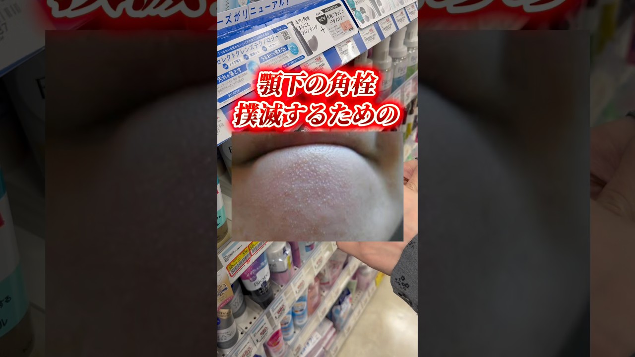 ドラストで買える顎下のニキビに効くコスメ！