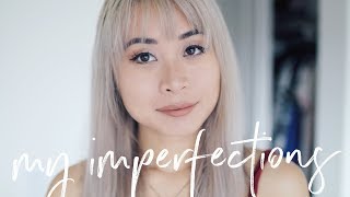 My Perfect Imperfections Tag | Biggest Flaws & Insecurities