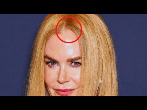 New Update!! Breaking News Of Nicole Kidman || It will shock you