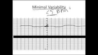 Download lagu NonStress Test Made Simple mp3