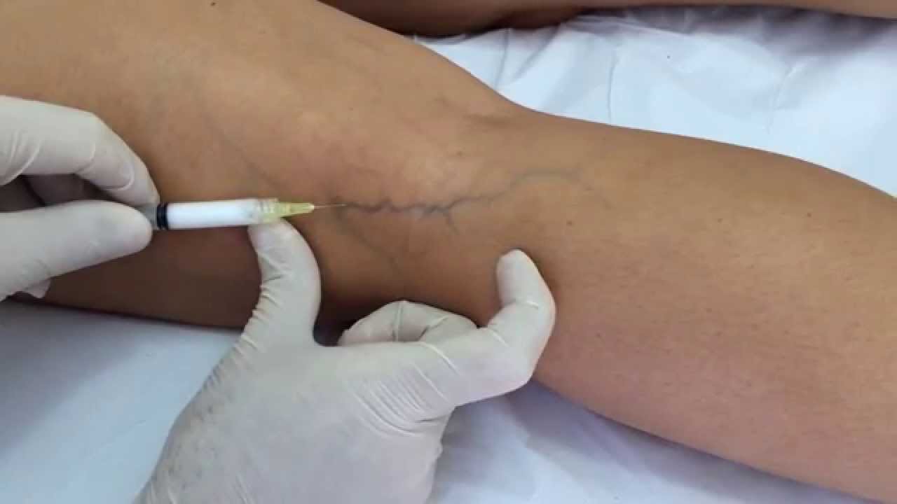 Itzi Peralta Martínez-0