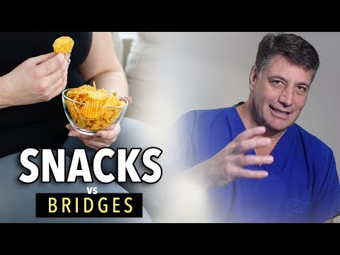 Ep:04 Snacks vs Bridges