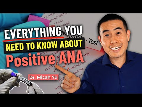 I have a positive ANA test, NOW WHAT? Rheumatologist Explains