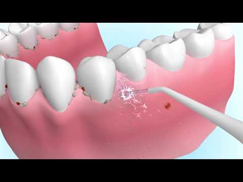 Aquapick AQ-220 Taşınabilir Ağız duşu