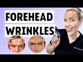 Improve Forehead Wrinkles Without Botox 3 At Home Tips