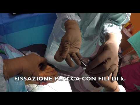 Trattamento della colonna vertebrale in luoghi di cura di Kislovodsk La struttura delle articolazioni interfalangee