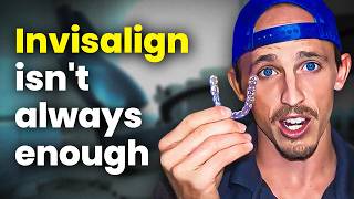 Why INVISALIGN fails