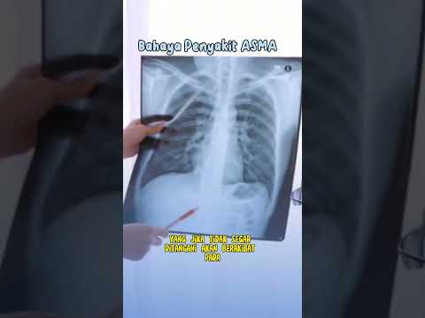 Jaga kesehatan pernapasanmu ya! Asma bisa jadi bahaya jika tidak ditangani dengan baik. 🌬️✨