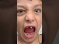 Oliver and Lucas Pull a Loose Tooth 🦷 Losing a Baby Tooth #educationalvideosforkids