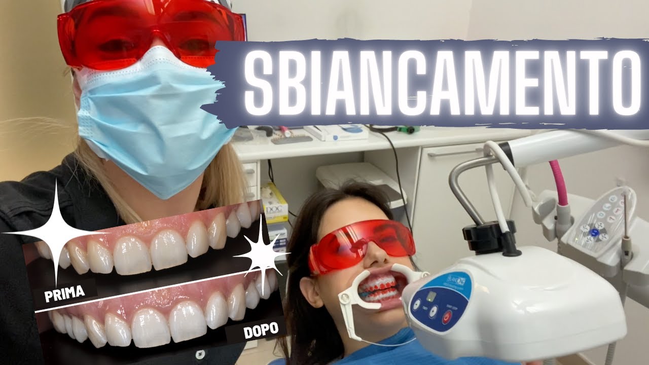 Watch Now SBIANCAMENTO dei DENTI in studio - Prima e Dopo e intervista a Jasmine SBIANCAMENTO dei DENTI in studio - Prima e Dopo e intervista a Jasmine