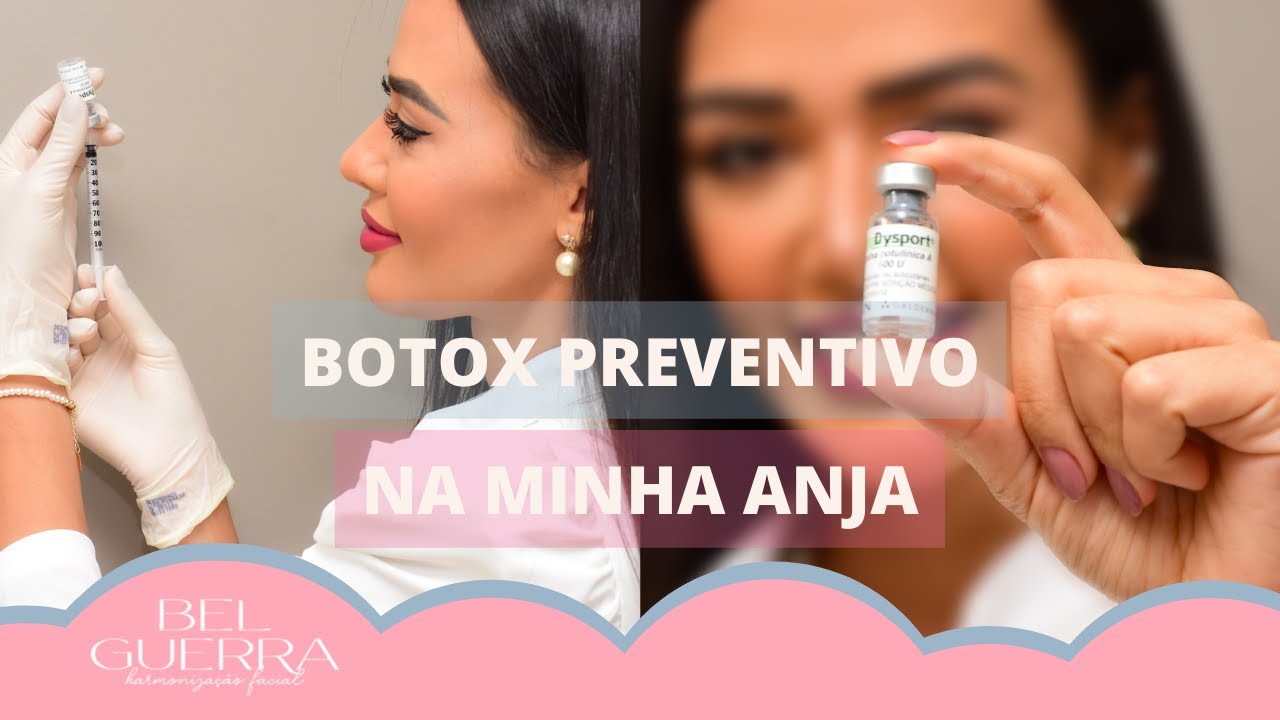 APLICANDO BOTOX PREVENTIVO NA MINHA ESTAGIÁRIA