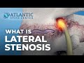 What Is Lumbar Lateral Stenosis? | Foraminal Stenosis