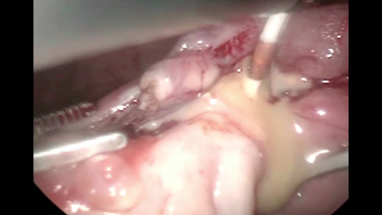 Carlos Alberto Alfaro Miranda-7