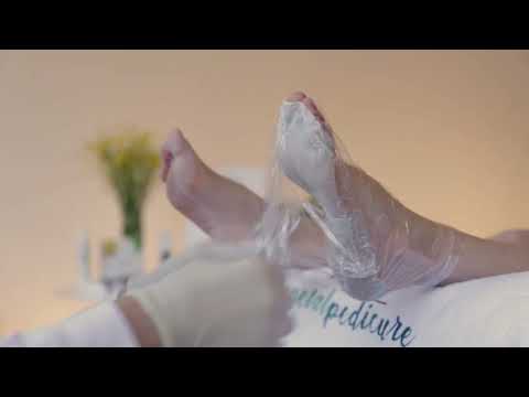 Mavex Calluspeeling VEG - Video Demonstration