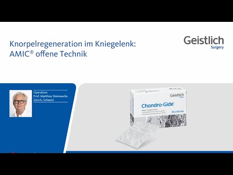 Salbe für Gelenke für Mensch und Tier Geschwollene Gelenke in den Fingern der Hand