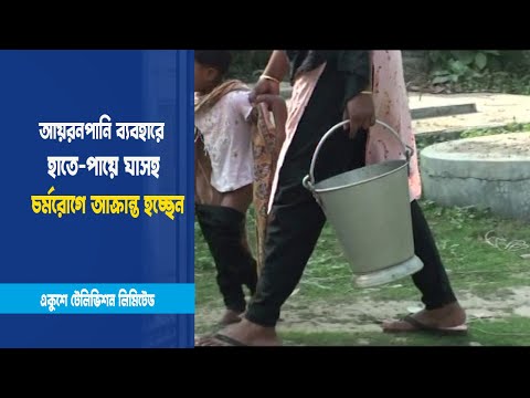 ৩০ বছর ধরে আয়রনযুক্ত পানি ব্যবহার