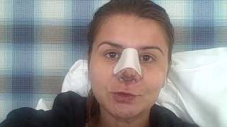 Teodora’s Beverly Hills Nose Job: Day 5