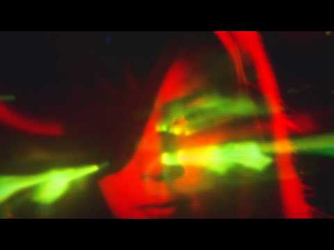 Thumbnail for When Soviet Youth Bootlegged Western Rock Music on Discarded X‑Rays: Hear Original Audio Samples