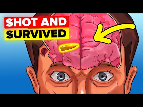 Survive Getting Shot (Minute by Minute)