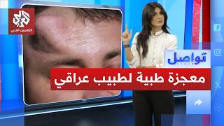 طبيب عراقي ينجح في زراعة أنف في رأس بشري.. ما القصة؟│ تواصل