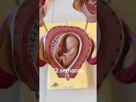 12 semanas. #medicina #ecografia #bebe #ginecologia #obstetricia #embarazofeliz