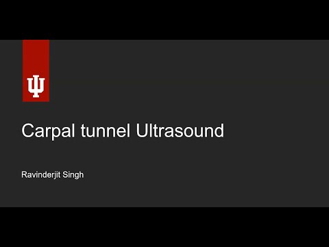 Carpal Tunnel Syndrome