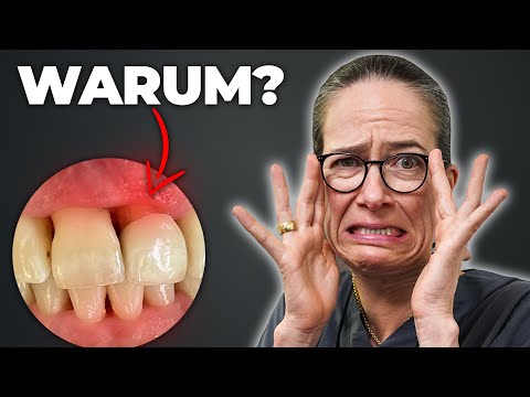HILFE! Mein Zahnfleisch verschwindet... WAS jetzt tun?