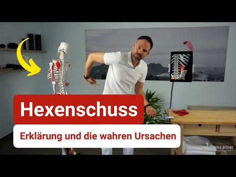 Lumbago explained - This is the real cause ⚡