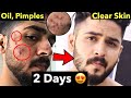 10 Pimple Mistakes How To Remove Pimples From Face Remove Acne Naturally