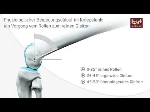 Innovative Knieorthetik: BORT Polkurvengelenk