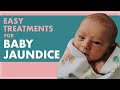 BABY JAUNDICE Treating JAUNDICE In Babies From HOME