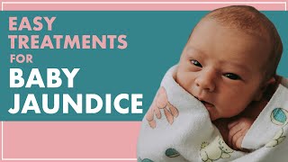 BABY JAUNDICE | Treating JAUNDICE In Babies From HOME