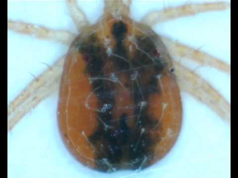 A Clover Mite (I think) viewed with a USB Microscope at 800x magnification.