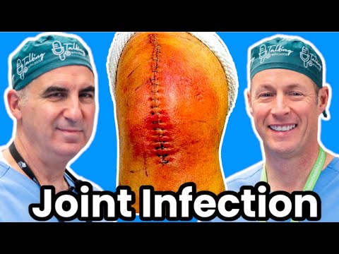 How To Tell If Your Joint Replacement Is Infected