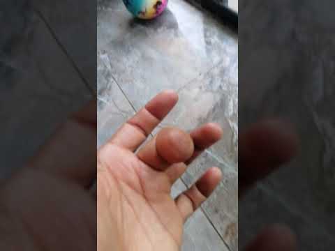 Amputee fingers. Dedos amputados