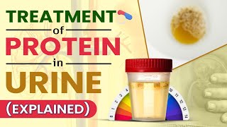 Treatment Of Protein In Urine (Explained)